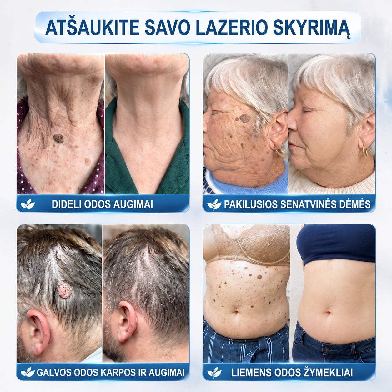 ✨𝐎𝐟𝐢𝐜𝐢𝐚𝐥𝐢 𝐩𝐫𝐞𝐤ė𝐬 ž𝐞𝐧𝐤𝐥𝐨 𝐩𝐚𝐫𝐝𝐮𝐨𝐭𝐮𝐯ė Hiskin® 𝟕 𝐝𝐚𝐲 𝐊𝐚𝐫𝐩𝐮𝐜𝐢𝐮 𝐢𝐫 𝐝𝐞𝐦𝐢𝐲 𝐯𝐚𝐥𝐢𝐤𝐥𝐢𝐬(Neskausmingas, be pėdsakų rutulinis rutulinis) 🚀