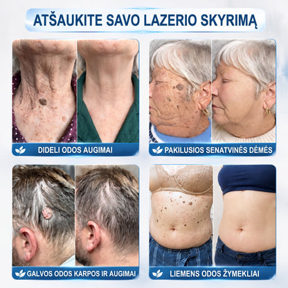 ✨𝐎𝐟𝐢𝐜𝐢𝐚𝐥𝐢 𝐩𝐫𝐞𝐤ė𝐬 ž𝐞𝐧𝐤𝐥𝐨 𝐩𝐚𝐫𝐝𝐮𝐨𝐭𝐮𝐯ė Hiskin® 𝟕 𝐝𝐚𝐲 𝐊𝐚𝐫𝐩𝐮𝐜𝐢𝐮 𝐢𝐫 𝐝𝐞𝐦𝐢𝐲 𝐯𝐚𝐥𝐢𝐤𝐥𝐢𝐬(Neskausmingas, be pėdsakų rutulinis rutulinis) 🚀