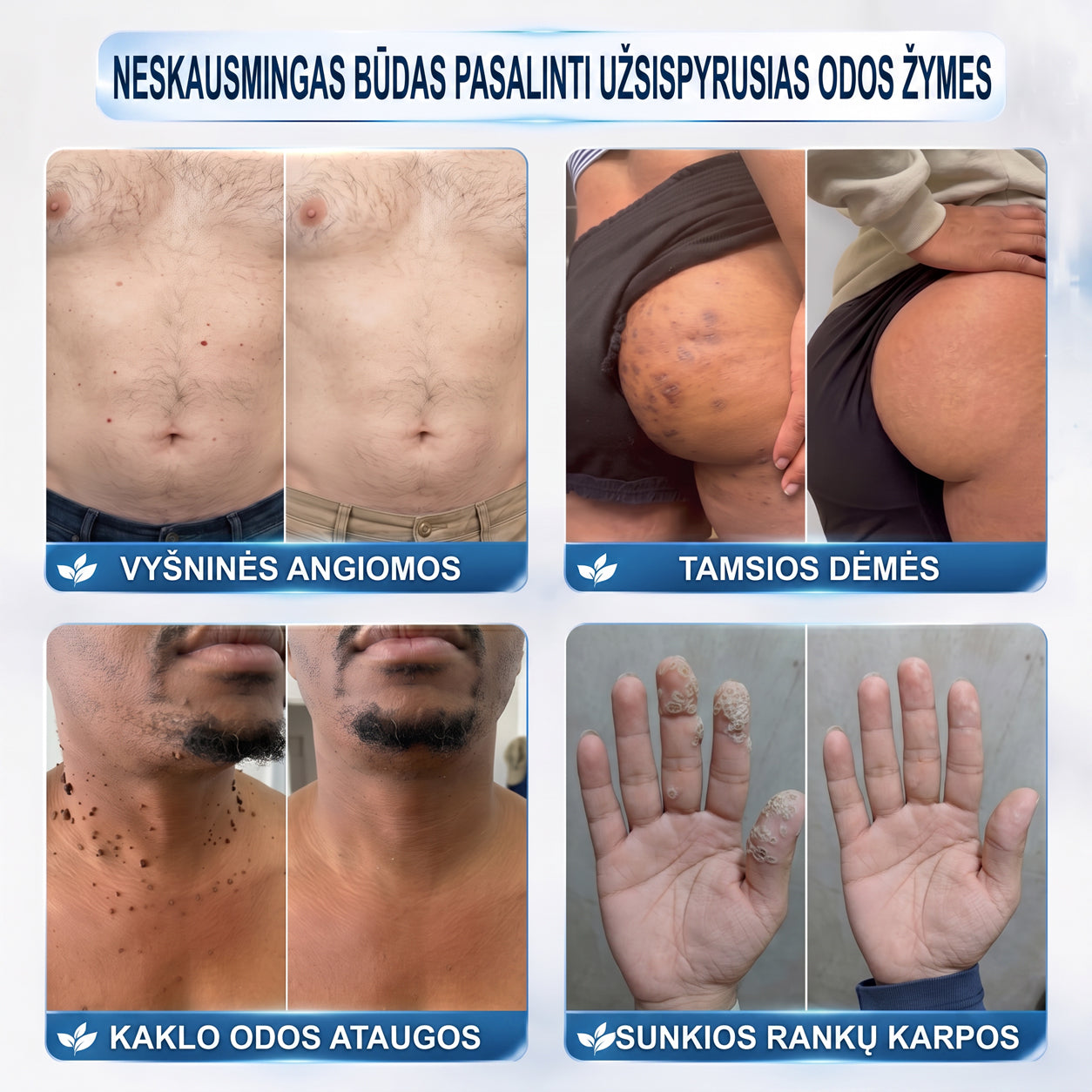 ✨𝐎𝐟𝐢𝐜𝐢𝐚𝐥𝐢 𝐩𝐫𝐞𝐤ė𝐬 ž𝐞𝐧𝐤𝐥𝐨 𝐩𝐚𝐫𝐝𝐮𝐨𝐭𝐮𝐯ė Hiskin® 𝟕 𝐝𝐚𝐲 𝐊𝐚𝐫𝐩𝐮𝐜𝐢𝐮 𝐢𝐫 𝐝𝐞𝐦𝐢𝐲 𝐯𝐚𝐥𝐢𝐤𝐥𝐢𝐬(Neskausmingas, be pėdsakų rutulinis rutulinis) 🚀
