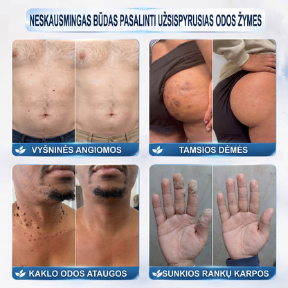 ✨𝐎𝐟𝐢𝐜𝐢𝐚𝐥𝐢 𝐩𝐫𝐞𝐤ė𝐬 ž𝐞𝐧𝐤𝐥𝐨 𝐩𝐚𝐫𝐝𝐮𝐨𝐭𝐮𝐯ė Hiskin® 𝟕 𝐝𝐚𝐲 𝐊𝐚𝐫𝐩𝐮𝐜𝐢𝐮 𝐢𝐫 𝐝𝐞𝐦𝐢𝐲 𝐯𝐚𝐥𝐢𝐤𝐥𝐢𝐬(Neskausmingas, be pėdsakų rutulinis rutulinis) 🚀