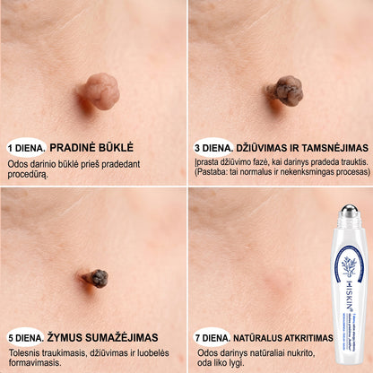 ✨𝐎𝐟𝐢𝐜𝐢𝐚𝐥𝐢 𝐩𝐫𝐞𝐤ė𝐬 ž𝐞𝐧𝐤𝐥𝐨 𝐩𝐚𝐫𝐝𝐮𝐨𝐭𝐮𝐯ė Hiskin® 𝟕 𝐝𝐚𝐲 𝐊𝐚𝐫𝐩𝐮𝐜𝐢𝐮 𝐢𝐫 𝐝𝐞𝐦𝐢𝐲 𝐯𝐚𝐥𝐢𝐤𝐥𝐢𝐬(Neskausmingas, be pėdsakų rutulinis rutulinis) 🚀